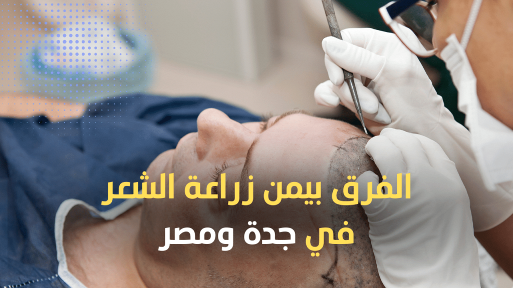 الفرق بين زراعة الشعر في جدة وفي مصر